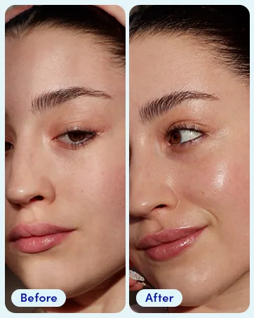 Sand & Sky Tasmanian Spring Water Splash Serum. Hyaluronic Acid for soft and plump skin. - before and after