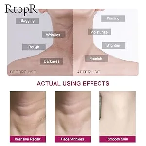 RtopR Neck Cream Moisturizing - Anti-Aging Neck Cream