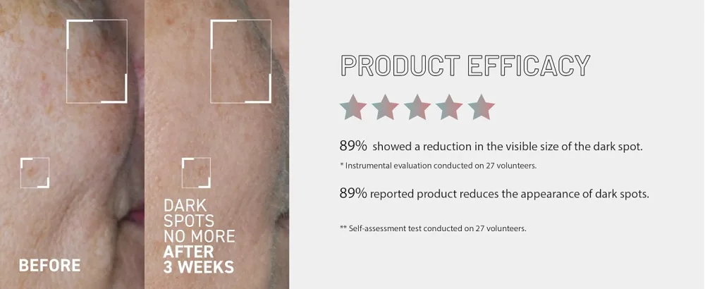 Dr. Brandt Bright This Way Dark Spots No More - Reduces Number Intensity and Size of Pigmented Spots - 0.5 fl oz / 15 ml - Efficacy