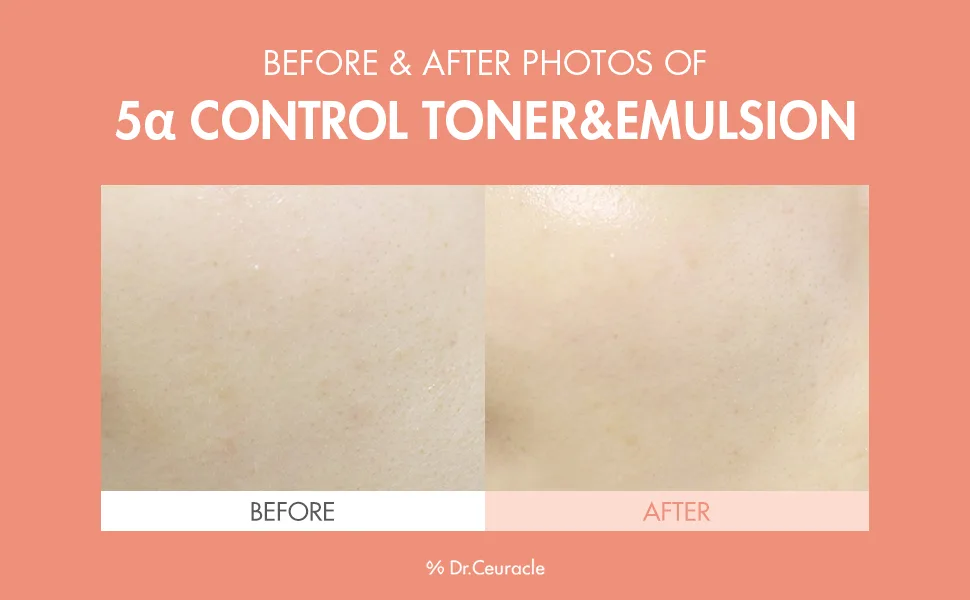 Dr.Ceuracle 5 Control Clearing Serum In Emulsion 100ml - 5 alpha