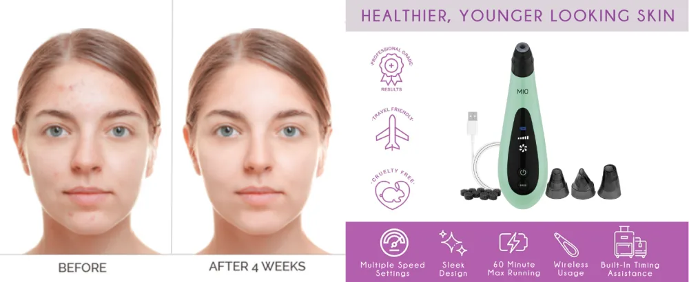 Spa Sciences MIO Microdermabrasion Replacement Filters - mio, healthier, younger looking skin
