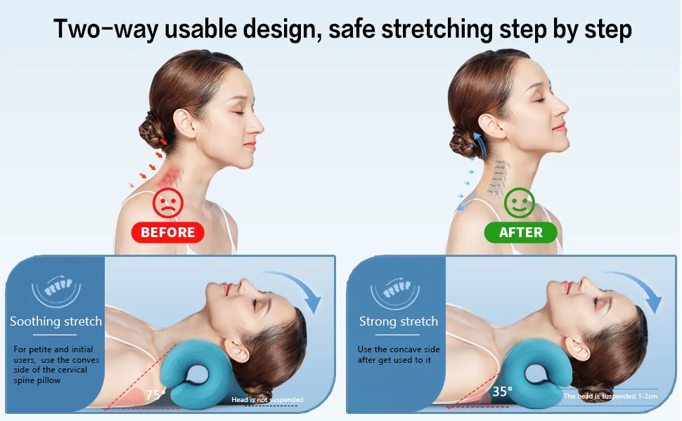 Neck and Shoulder Relaxer,Portable Cervical Traction Device Neck Stretcher,Neck Posture Corrector Chiropractic Pillow for TMJ Pain Relief and Cervical Spine Alignment-Blue - cervical traction