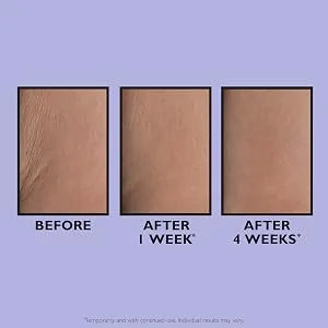 Peter Thomas Roth | PRO Strength Stretch Mark Cream Treatment For Body Stretch Marks Uneven Tone and Texture Moisturizing Stretch Mark Cream - PRO Strength Stretch Mark Cream, peter thomas roth, usage, before and after, b&a