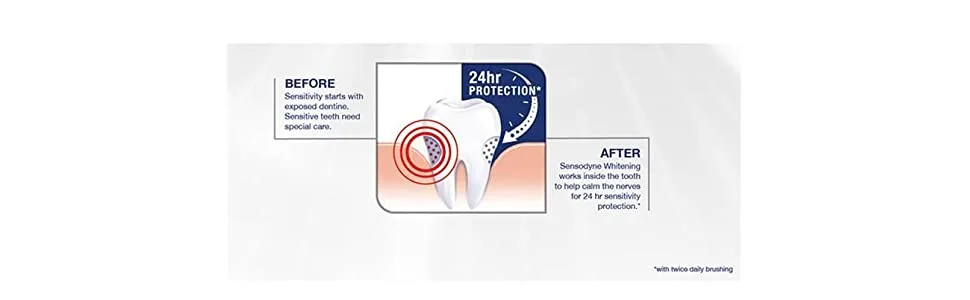 Sensodyne Whitening Toothpaste With Fluoride 70 gm - How it Works