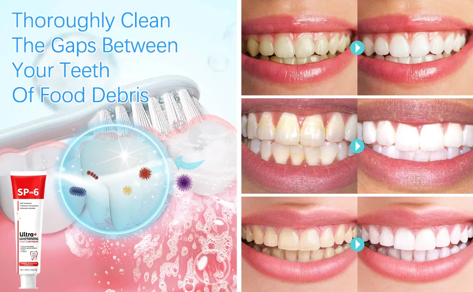 Super Probiotic Sp-6 Toothpaste Sp-6 Ultra Whitening Toothpaste Sp 6 Toothpaste Sp-6 Toothpaste Fresh Breath 9.8 oz - sp-6 ultra whitening toothpaste