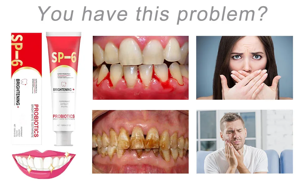 Sp 6 Toothpaste Probiotics Bright White Toothpaste Sp-6 Ultra White Toothpaste Ultra White Toothpaste Sp-6 Sp-6 Probiotics Whitening Toothpaste Fresh Breath - Sp 6 Toothpaste
