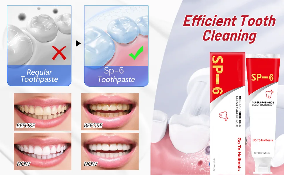 Sp-6 Ultra Whitening Toothpaste Ultra White Toothpaste Sp-6 Super Probiotic 6 Toothpaste-with 6 Probiotics Microbiota Fresh Breath 4.23 oz - sp-6 ultra whitening toothpaste sp 6 ultra whitening sp 6 probiotic toothpaste whitening