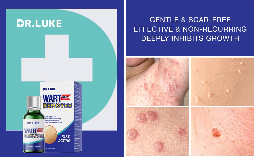 Dr. Luke Fast Action Liquid Wart Remover for Men & Women Exclusive Formula Wart Products for Genital Wart Common Wart Filiform Wart Flat Wart and Tiny Wart - Dr. Luke Wart