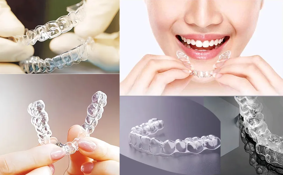 Custom Night Guard Custom Mouth Teeth Guards Against Teeth Grinding/Clenching Dental Retainer for TMJ Relief and Bruxism (One Upper Guard) - custom night guard teeth guard mouth guards dental retainer day guards braces teethguard mouthguard