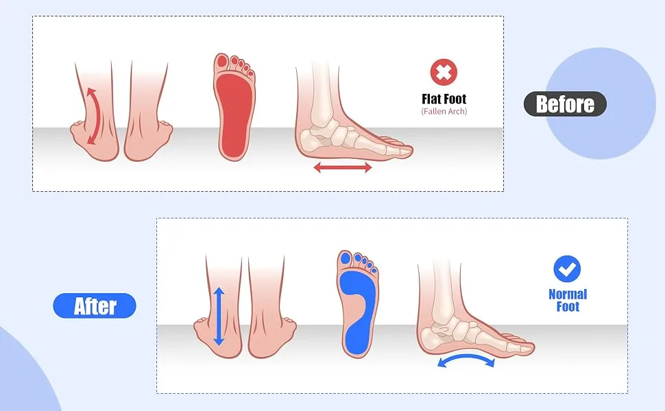 Bunion Corrector - Toe Separation Arch Trainer | Crescent-Shaped Sole for Enhanced Leg Tightening Hip Lifting & Abdominal Toning | Blue - Foot Exerciser - arch trainer