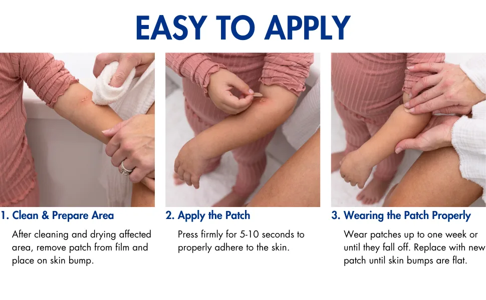 Hydrogel Patches - Smooths Skin Bumps - Dermatologist Invented Hydrating Patches - 48 Patches - Easy to apply