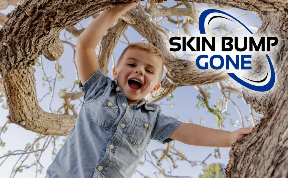 Hydrogel Patches - Smooths Skin Bumps - Dermatologist Invented Hydrating Patches - 48 Patches - Skin Bump Gone