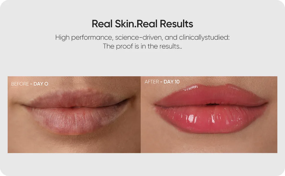 Red Light Therapy Lip Plumper Device Lip Plumping Enhancer LED Light Therapy Device for Lips Lip Plumper Tool Anti-Aging Lip Plumper for Fine Lines Enhance Lip Tone - product information 5