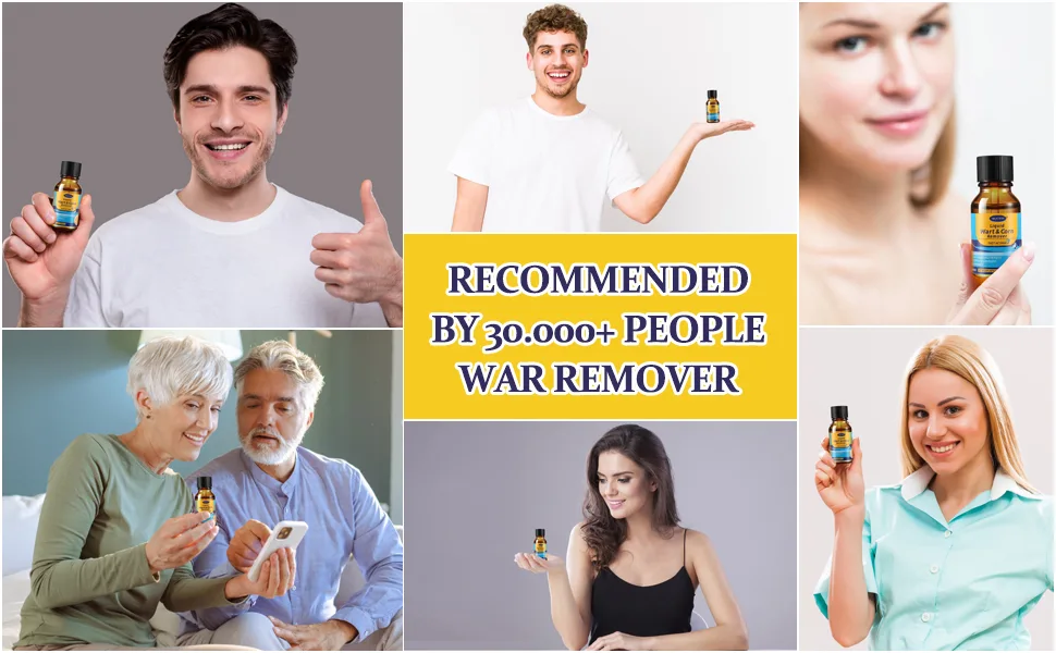 Wart Corn Remover Liquid Smoothes Skin Gentle Fast Acting Gel Wart Removal for Plantar Wart Flat Warts and Corns (M02) - wart Removal Liuqid