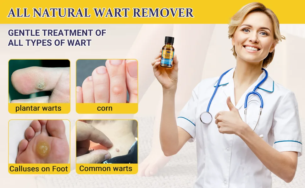 Wart Corn Remover Liquid Smoothes Skin Gentle Fast Acting Gel Wart Removal for Plantar Wart Flat Warts and Corns (M02) - Wart Remover Liquid