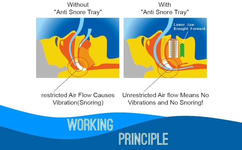 Advanced Custom Molding Mouthpiece - WORKING PRINCIPLE OF Custom Molding Mouthpiece