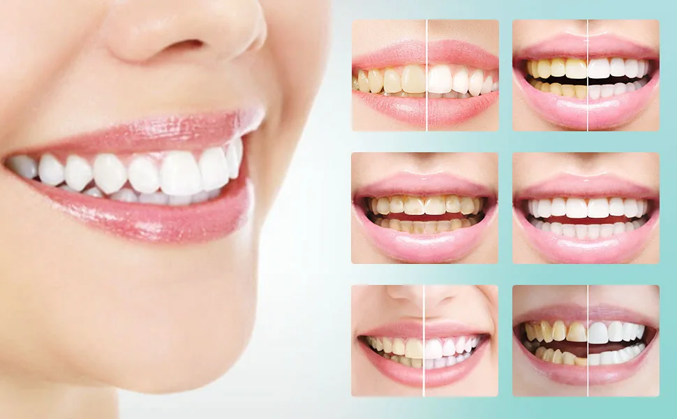 Teeth Whitening Foam Toothpaste Baking Soda Toothpaste Intensive Stain Removal Toothpaste Baking Soda Spearmint Whitening Mousse - whitening