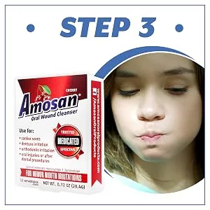 Oral Wound Cleanser - Cherry - Amosan Oral Wound Cleanser