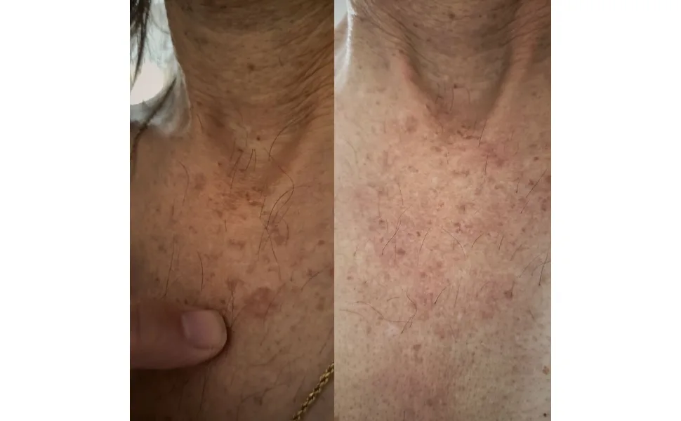 Shower Product - neck darkspot