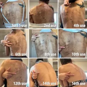 Shower Product - work fast dark spot remover