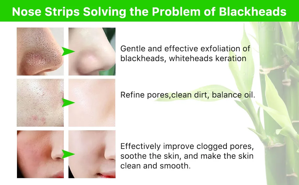 IDUCEN Pore Cleansing Strips - nose