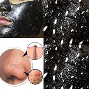 VLCC 7X Ultra Charcoal Peel Off Mask(100gm) - VLCC