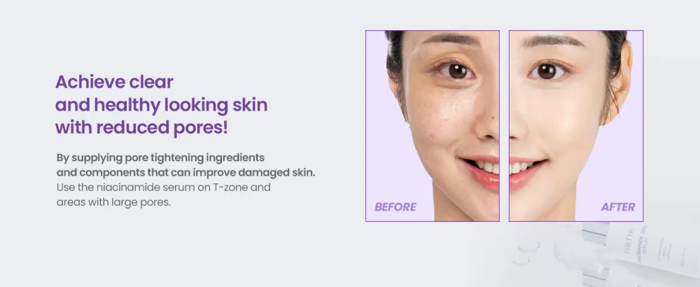 TIRTIR Niacinamide 20% Serum 30ml - ?????????_A????????_pc_page3