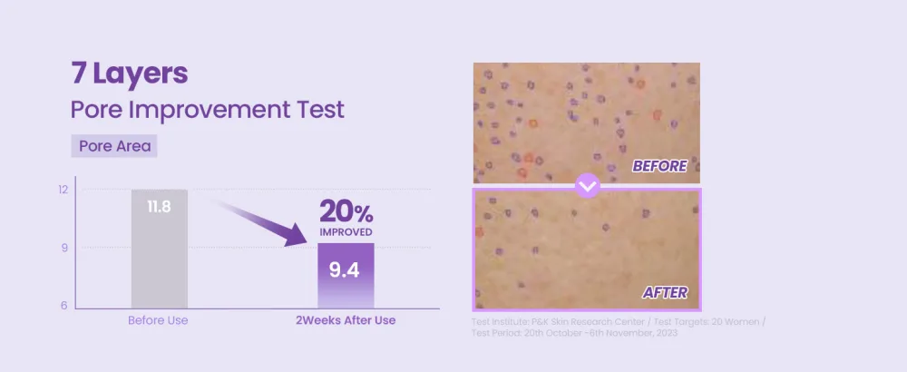 TIRTIR Niacinamide 20% Serum 30ml - pore improvement test Pore Area