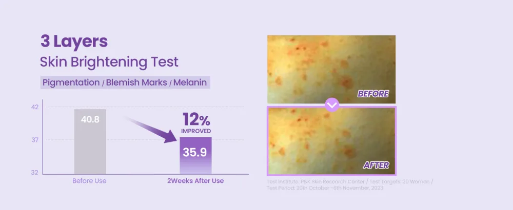 TIRTIR Niacinamide 20% Serum 30ml - Skin Brightening Test