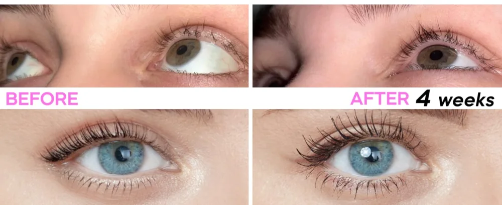 Stacy Lash Growth Serum (0.17fl.oz / 5ml) | Eyelash Enhancing Serum for Natural Lashes & Brows | Lash Serum for Eyelash Growth and Thickness - cold-pressed,cheap,enchinador,thicker,brows,curler,separator,tool,seller,shampoo,spoolies,rated