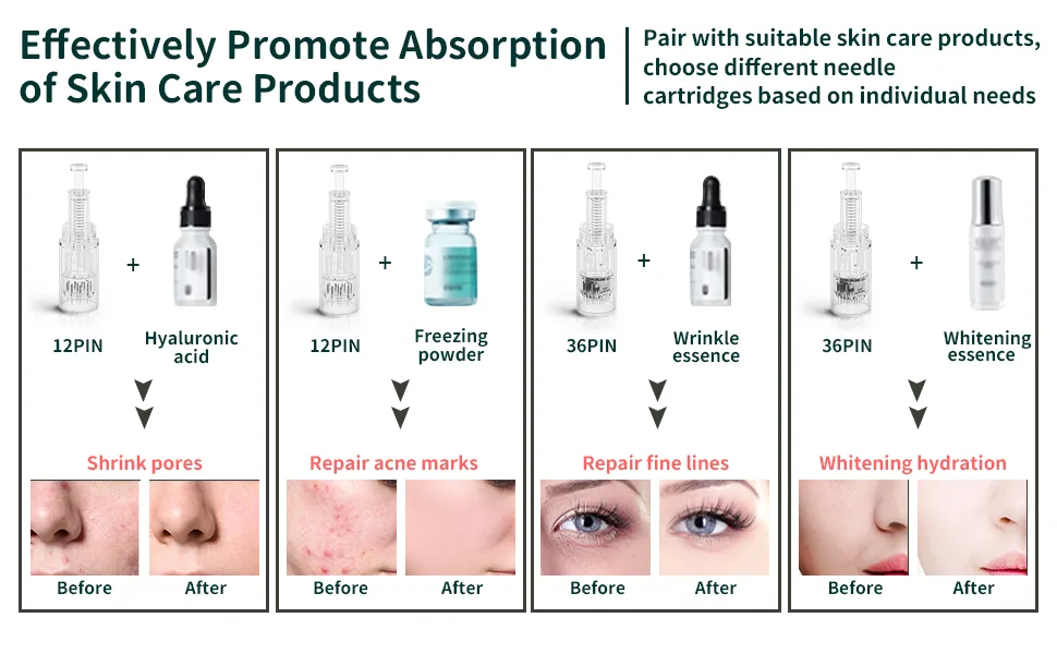 Microneedling Pen Electric Derma Pen with 20 Replacement Cartridges, Adjustable Microneedle Dermapen for Face Body Home Use - product information 3