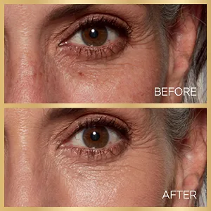 L'Oreal Paris Age Perfect Radiant Concealer with Hydrating Serum and Glycerin, Ivory 200 Ivory - undereye circle concealer