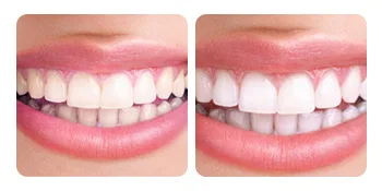 Teeth Powder 1.05 Ounce (Pack of 1) - product information 12