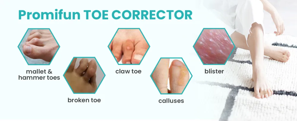 10 Pack Fabric Hammer Toe Corrector Reusable Broken Toe Protectors Taped Wraps Hammertoe Straightener Toe Splint for Broken Toe Crooked Toes Bent Toes (Brown 5L+5S) - Hammer Toe
