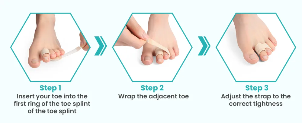 10 Pack Fabric Hammer Toe Corrector Reusable Broken Toe Protectors Taped Wraps Hammertoe Straightener Toe Splint for Broken Toe Crooked Toes Bent Toes (Brown 5L+5S) - Hammer Toe