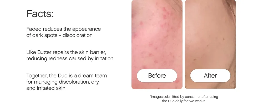 Topicals Ultimate Bundle - Includes Faded Serum for Dark Spots & Like Butter Moisturizer for Dry Sensitive & Eczema-Prone Skin Both 1.7 Fl Oz - Together, the Duo is a dream team for managing discoloration, dry, & irritated skin