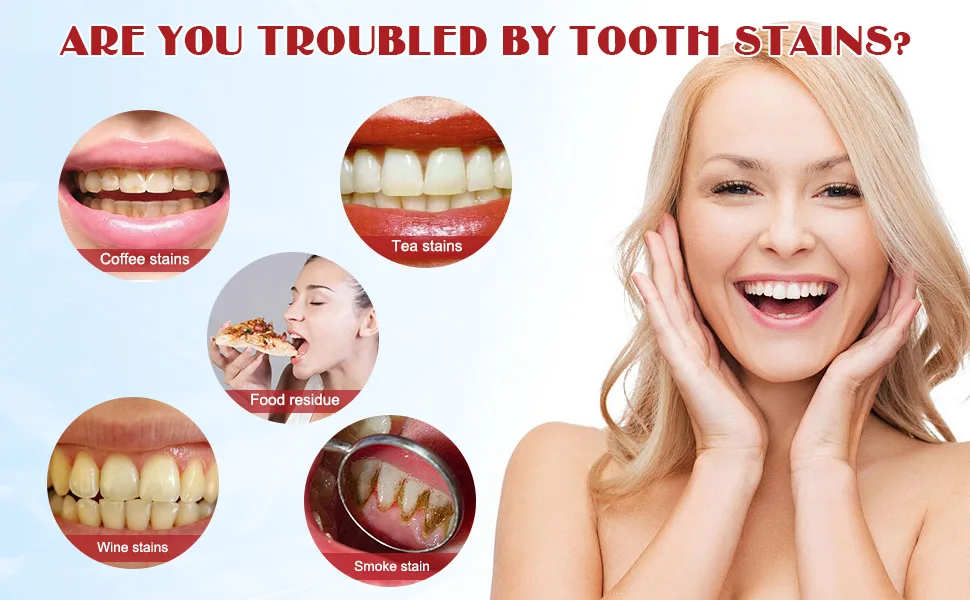Sp-7 Probiotic Toothpaste Sp-7 Probiotic Whitening Toothpaste Sp-7 Fresh Breath Toothpaste Brightening & Stain Removing Toothpaste (2Pcs with 2 toothbrushes) - Sp-7 Probiotic Whitening Toothpaste
