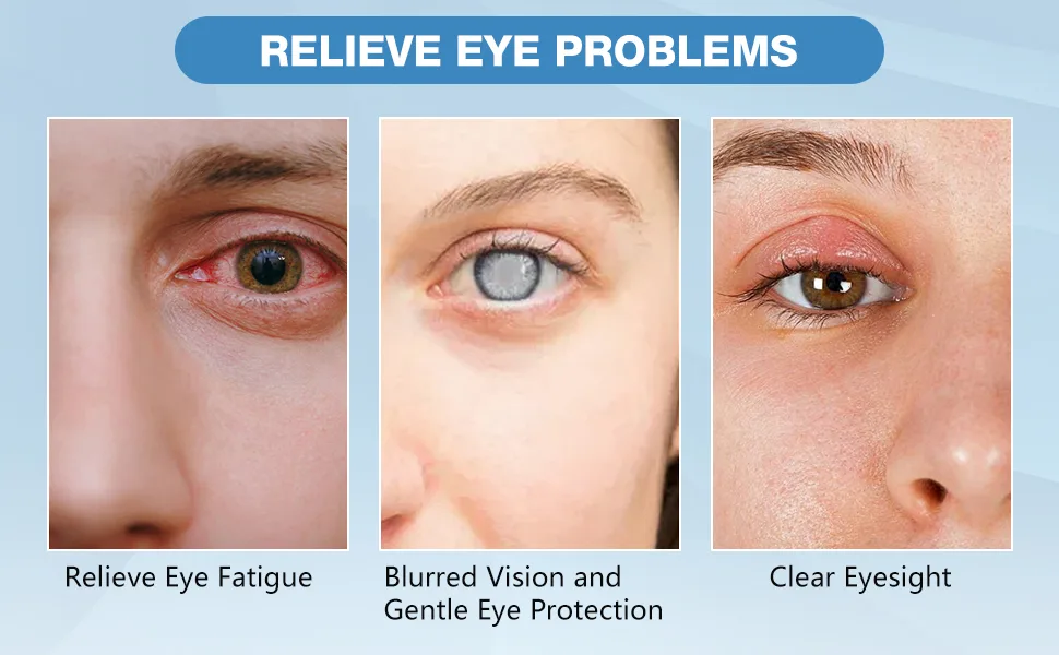 Myopia Reversal Eye Drops Improve Eye Problem Solution Drops Eye Brightening Drops Relieve Eye Fatigue Blurred Vision and Gentle Eye Protection Clear Eyesight (2Pcs) - Eye Brightening Drops