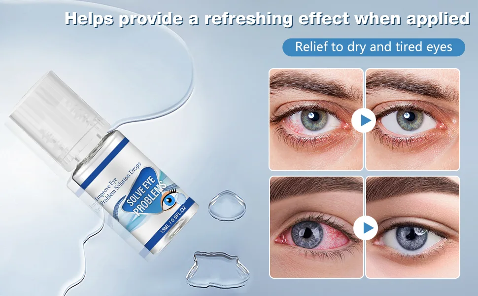 Myopia Reversal Eye Drops Improve Eye Problem Solution Drops Eye Brightening Drops Relieve Eye Fatigue Blurred Vision and Gentle Eye Protection Clear Eyesight (2Pcs) - Improve Eye Problem Solution Drops
