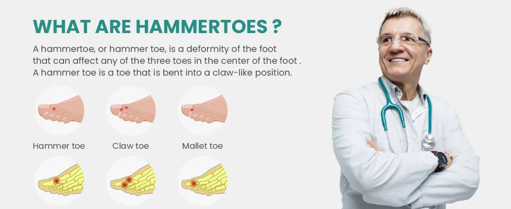 Welnove Hammer Toe Corrector and Straightener - 8 Pcs Toe Support Pads Cushion - Realign Bent Crooked Curled Claw Hammer Toes - One Loop Design - hammer toe