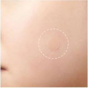 Spot Acne Patch - 72 patches Skin Blemish Treatment with Hydrocolloid | Blemish Acne Dot (Packaging May Vary) 72 Count (Pack of 1) - acne patch hydrocolloid natural