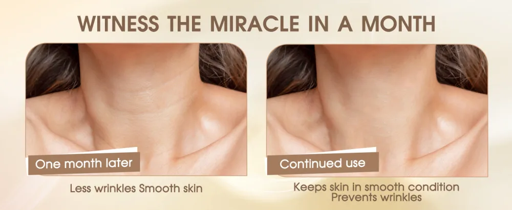 Forehead Wrinkle Patch Wrinkle Patch Reusable for The Prevention of Skin Wrinkles Sleep Overnight to Remove Wrinkles a Pack of Three Tablets - product information 7