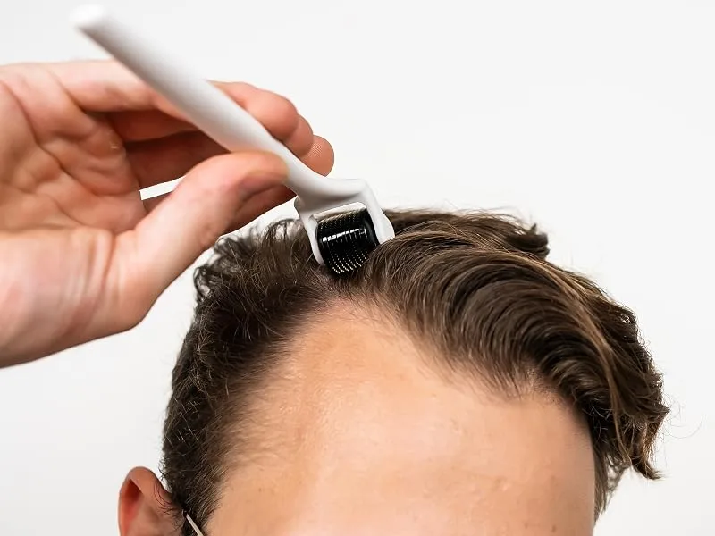 Scandinavian Biolabs Derma Roller made with 540 titanium 0.5 mm needles for Hair Growth - Scalp Activation Roller - scalp roller