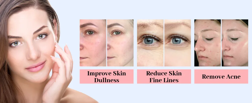 LED Face Light Therapy Mask: Spray Function LED Face Mask - 6 Colors LED Mask Light Therapy for Anti-Wrinkle Skin Care - led light mask