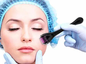 Inge Derma Roller | Derma Roller | 0.5mm 540 Titanium Needle Roller - dermaroller