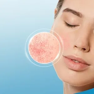 CETAPHIL PRO Redness Control Facial Cleansing Foam 236ml for Rosacea and Redness Prone Skin Non-Comedogenic - redness