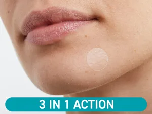 Compeed - Anti-Spots* Conceal & Go Patch - Cleanse Conceal and Protect Hydrocolloid Spots patches* Pimple patches - Ideal for discreet day use For single spots* - 15 Patches - compeed patches