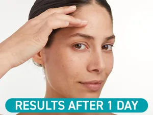 Compeed - Anti-Spots* Conceal & Go Patch - Cleanse Conceal and Protect Hydrocolloid Spots patches* Pimple patches - Ideal for discreet day use For single spots* - 15 Patches - compeed patches