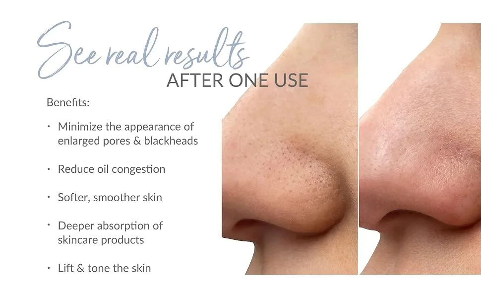 PMD Wave Pro - Professional-Grade Advanced Skin Spatula - Extract Infuse & Lift - SonicGlow Vibration Technology and EMS - Clear Pores Blackheads & Whiteheads - 7002-BTF-EU5