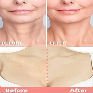 PHCOMRICH Reusable Anti Wrinkle Neck Pad Silicone Decollete Pads for Eliminate and Prevent Neck Wrinkles Anti Aging Transparent Pads (1pc) - wrinkle neck pads